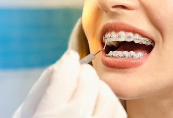 Your Guide to Orthodontic Treatments in Panorama City